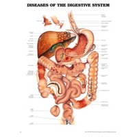 Diseases of the Digestive System