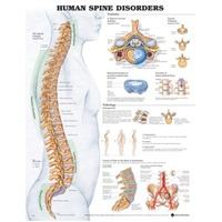 Human Spine Disorders