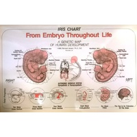 Iris and the Embryo chart (sale)
