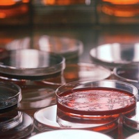 LWP Mycotoxins Test Kit