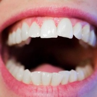 LWP Periodontal Test Kit