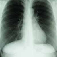 PH1 Respiratory System Test Kit
