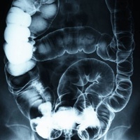 PH2 Lower Digestive System Test Kit