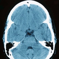 PH6C More Brain Test Kit