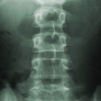 PH7B Vertebrae Test Kit