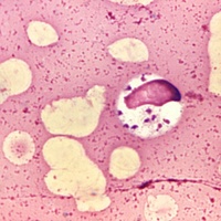 LWP Protozoa Test Kit