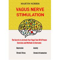 Vagus Nerve Stimulation