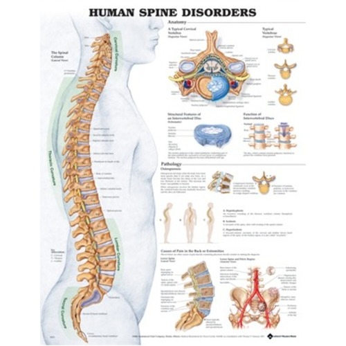Human Spine Disorders