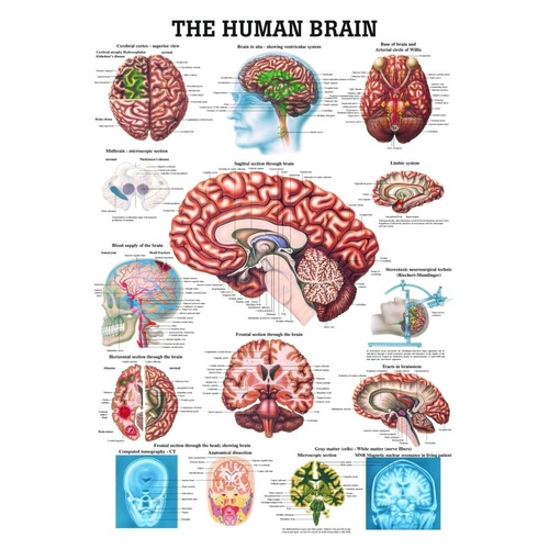 Larger Anatomical - Brain