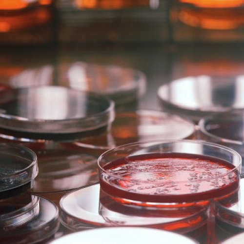 LWP Mycotoxins Test Kit