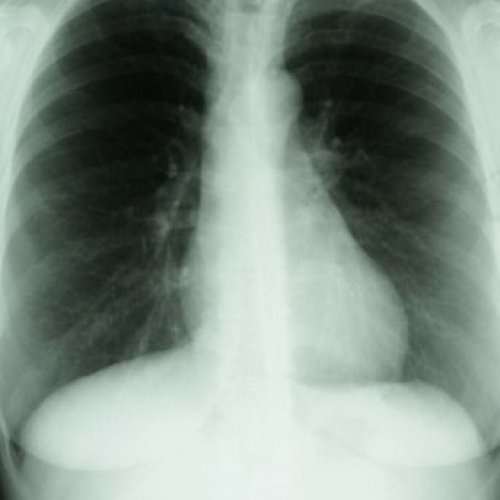 PH1 Respiratory System Test Kit